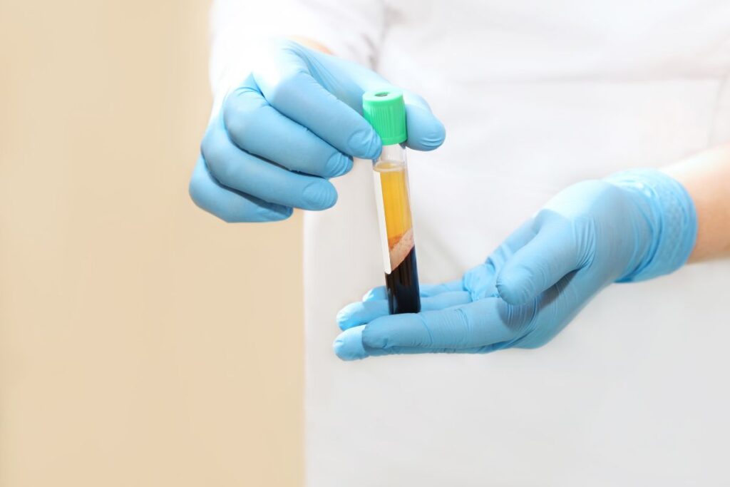 prp qu'est ce que c'est